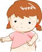 重庆朝天门皮肤病医院:湿疹的分型辨治与科学护理之路