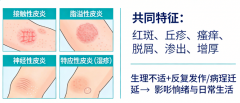探寻皮炎治疗新路径:重庆朝天门医院